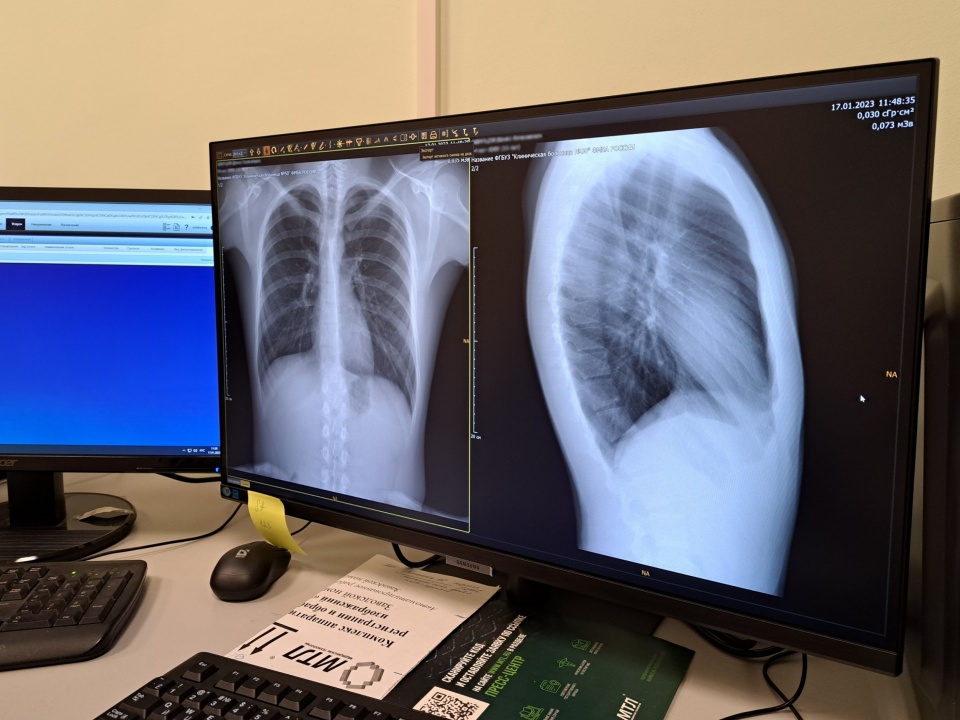 Флюорограф-3.jpg Флюорограф-3.jpg