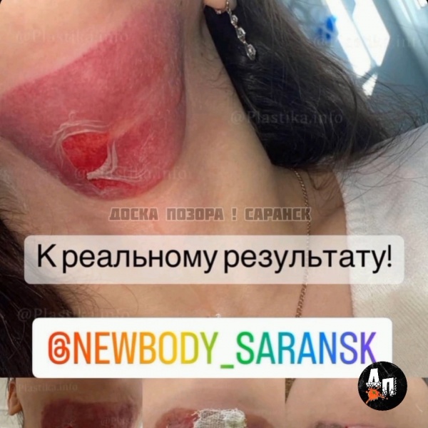 Жертва-1.jpg Жертва-1.jpg