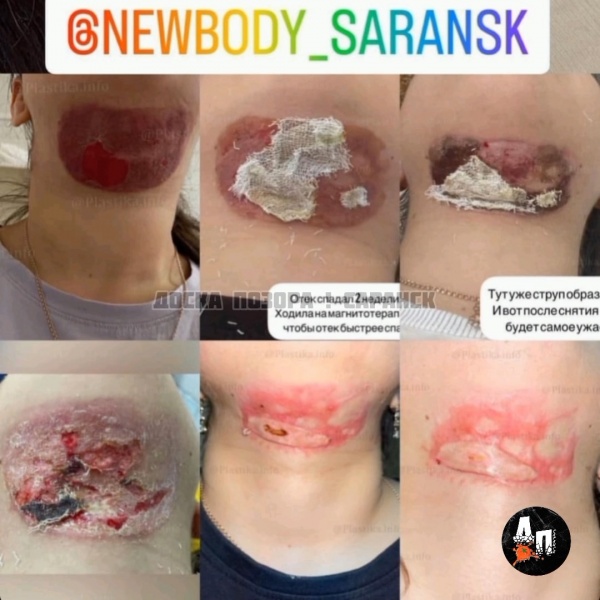 Жертва-2.jpg Жертва-2.jpg