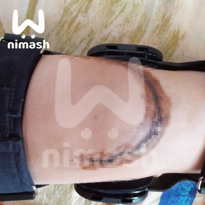 Нога-1.jpg Нога-1.jpg